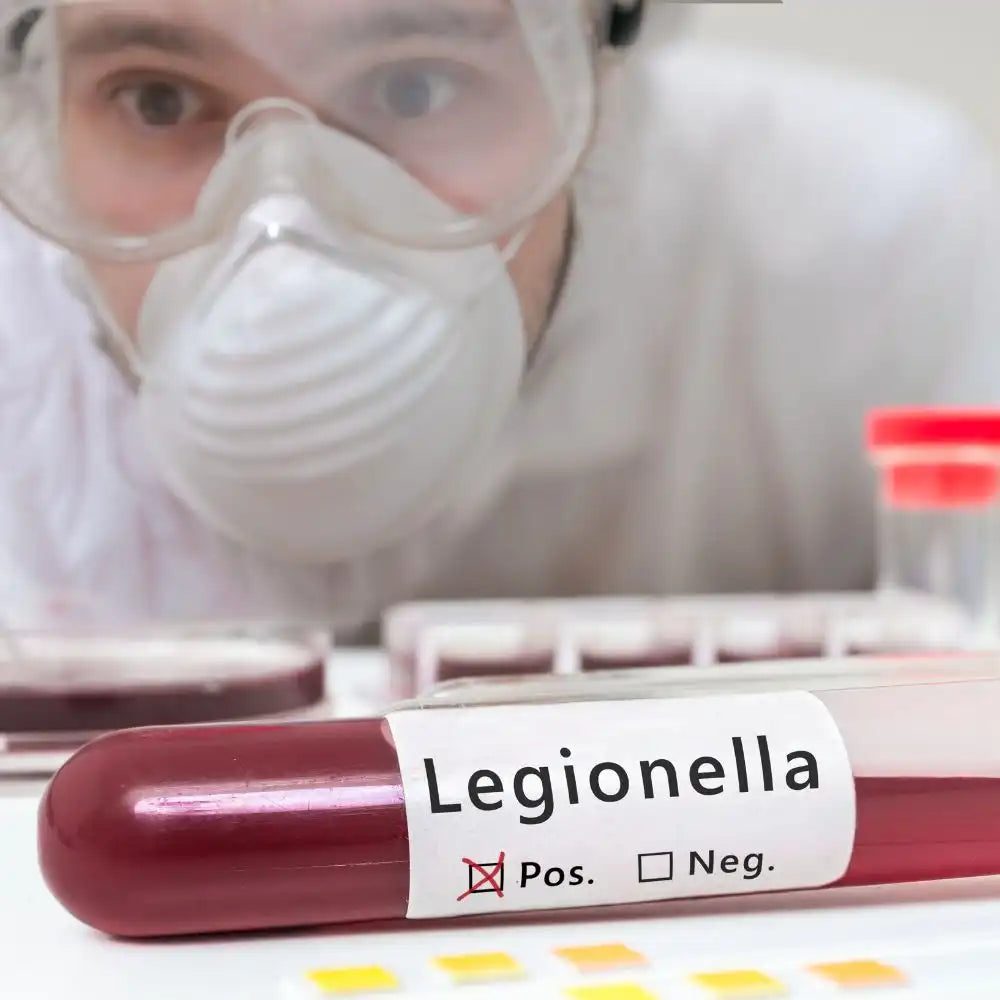 Rischio Legionella